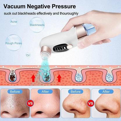 4-in-1 Bubble Beauty Instrument |